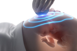 Ultrassonografia: um importante exame para as futuras mamães.
