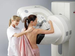 Mamografia Digital